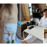 Sakit Ini yang Bikin Shin Tae-yong Balik Dioperasi Selama 6 Jam di Korea