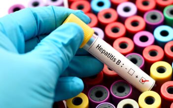 Waspada! 6,7 Juta Warga Indonesia Terinfeksi Hepatitis B, Ini Cara Penularannya